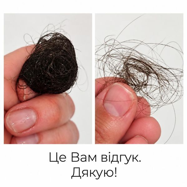Комплекс №9 проти випадіння, активізації росту та зміцнення волосся ECOVITA FOLLICLE RENEWAL SYSTEM  EV-SEA-31111 фото